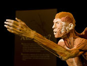 Like many of the plastic-inseminated bodies displayed in the “Body Worlds 3” exhibition at the St. Louis Science Center, The Hurdler (2005) represents the body in functional action. This sculpture and others create compelling—and sometimes unsettling—juxtapositions of internal anatomical features, such as the muscles and the sagittal sections of the brain shown here, and external features, including eyes, eyebrows, and lips.